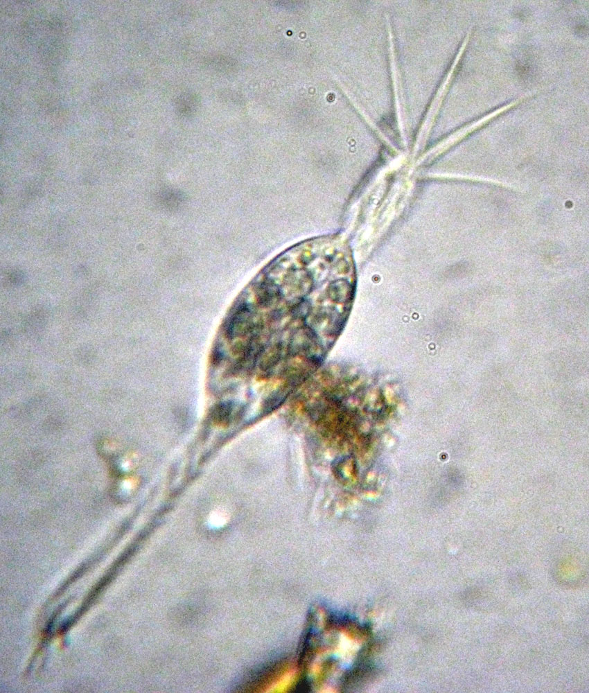 Protozoi marini: Psammomitra retractilis?
